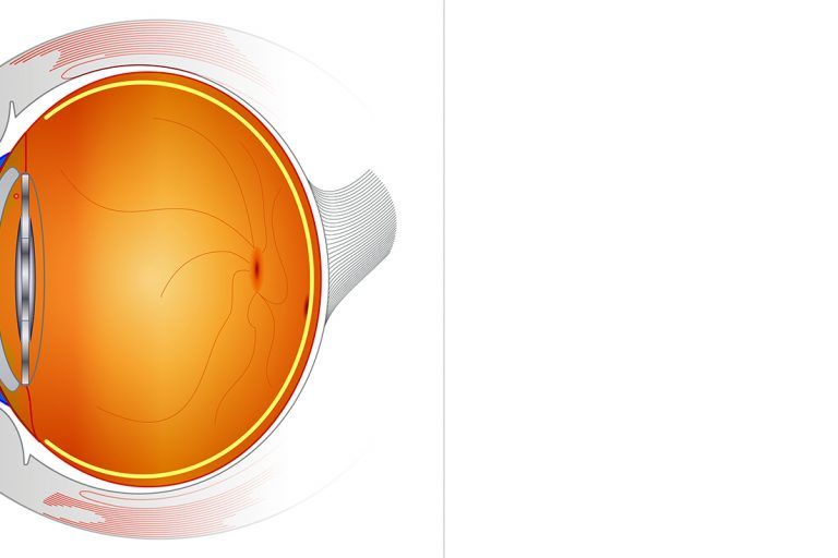 Lentes Trifocales
