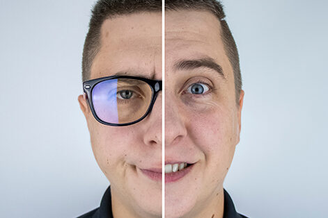 LASIK o PRK