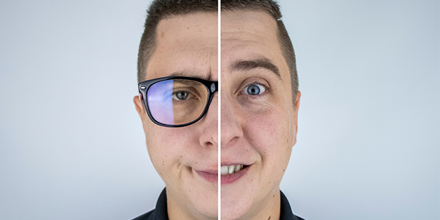 Diferencias Lasik prk 627px X 314px LASIK o PRK