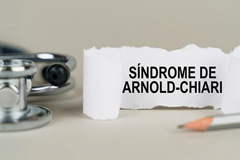 Sindrome de Arnold-Chiari
