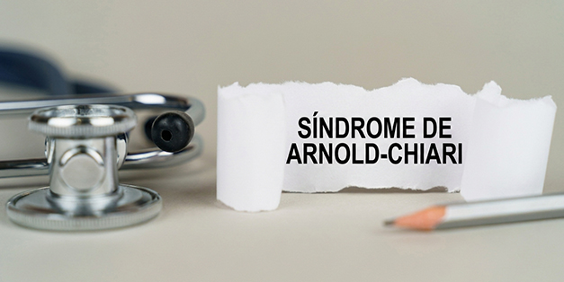 Sindrome de Arnold-Chiari